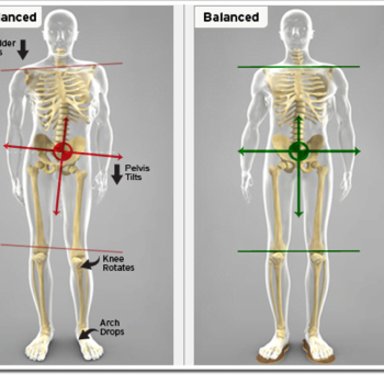 dorn-method-2.resim_